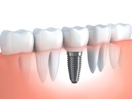  Genaral Dentistry in Davangere